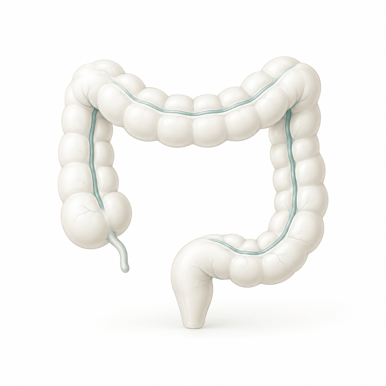 Colorectal Cancer